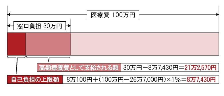 高額療養費の上限額と支給額の計算例