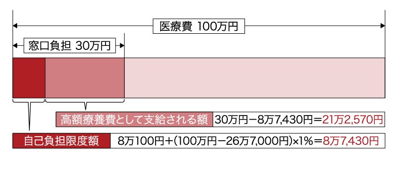 高額療養費における自己負担の限度額と支給額の計算例